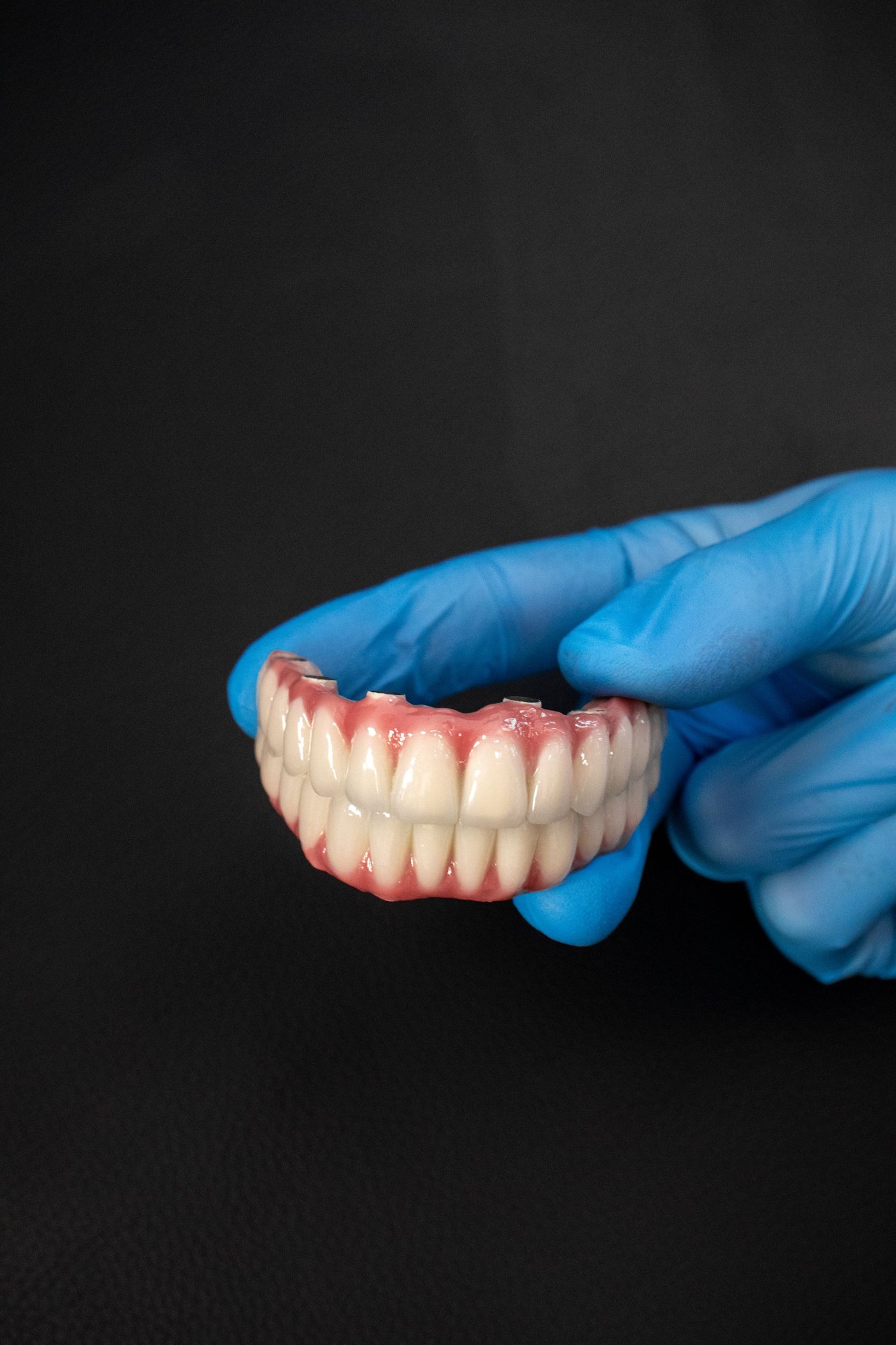 A full-arch implant denture held in a gloved hand