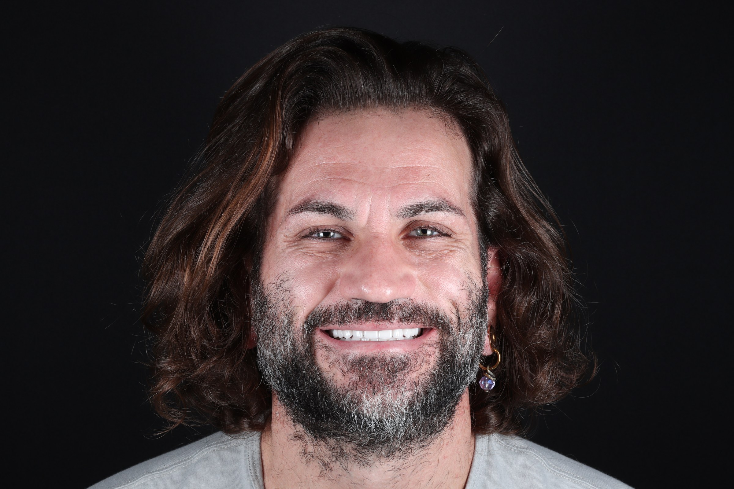 A West LA Implants patient smiling after his treatment