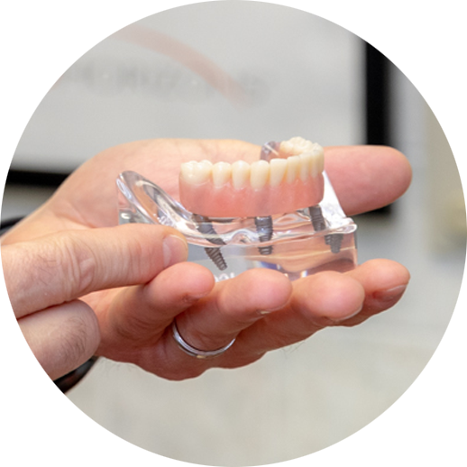 dental implants model